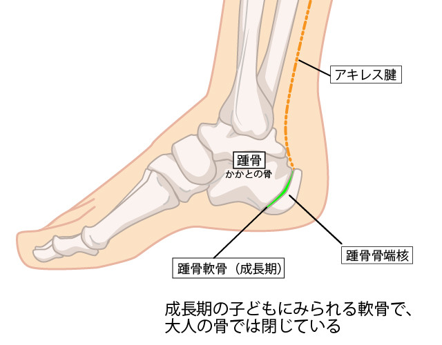 アキレス腱のイラスト