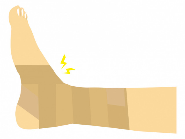 捻挫のイラスト
